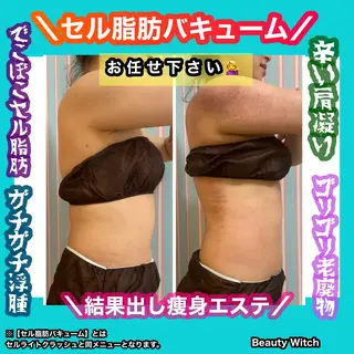 痩身/脱毛/ネイル HARUKAのエステ・リラクイメージ