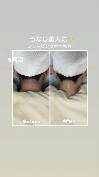 脱毛サロン　エクボ ミヤビのエステ・リラクイメージ