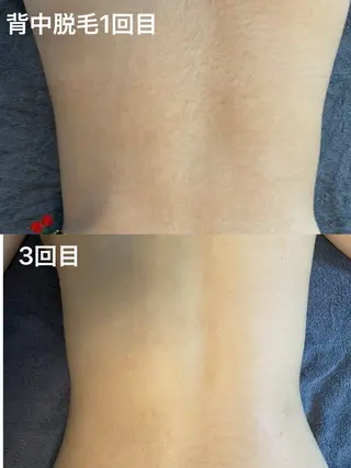 プライベート脱毛 Jr久宝寺のエステ・リラクイメージ