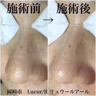 大久保 里奈のエステ・リラクイメージ