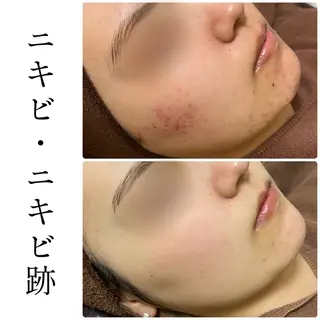 ハーブピーリング専門 BIOEL横浜のエステ・リラクイメージ