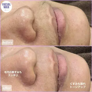 facial salon Lily所属・salon Lilyのエステ・リラクイメージ