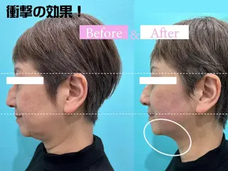 カンナムビューティー 新宿🦋碧.aoiのエステ・リラクイメージ
