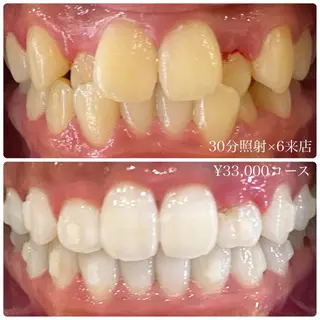 PLATINUM Beauty 横浜店所属・ホワイトニングルーム 横浜店のその他イメージ