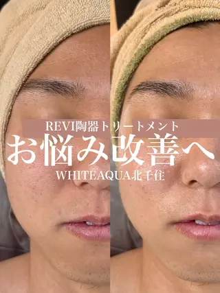 WHITE AQUA 北千住店のエステ・リラクイメージ