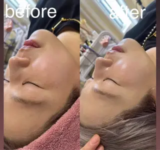 美容鍼灸サロン mahoroba院長のエステ・リラクイメージ