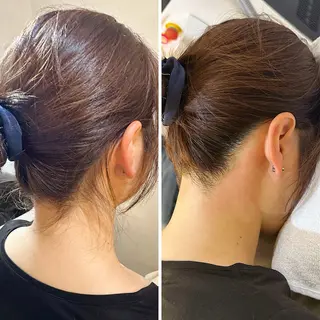 うなじ脱毛/美肌脱毛 LABELのエステ・リラクイメージ