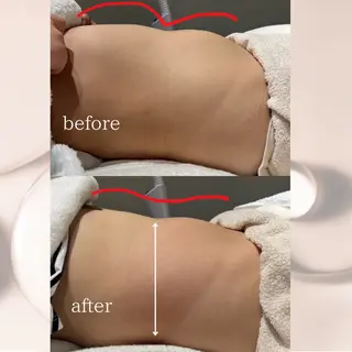 【vidyto】ヴィディトゥ所属・肌管理サロン vidyto MOEのエステ・リラクイメージ