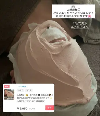 毛穴洗浄/ニキビ 肌質改善サロンのエステ・リラクイメージ