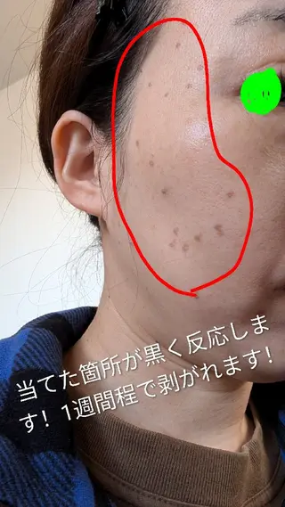 tms. mn.のエステ・リラクイメージ