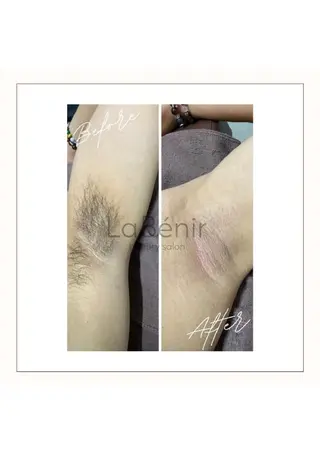 メンズ 脱毛/美肌【皮膚科看 護師経営】ラベニールのエステ・リラクイメージ