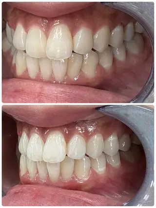 ecxia white 高田馬場所属・セルフホワイトニング エクシア 高田馬場のその他イメージ