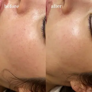 hitomi ヒトミのエステ・リラクイメージ