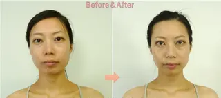 美容整サロン DOLCE のエステ・リラクイメージ