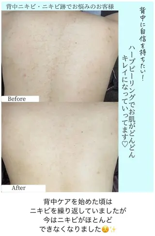 ベラージュ【美背中・ 美尻・フェイシャル】のエステ・リラクイメージ