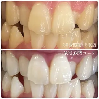 PLATINUM Beauty 横浜店所属・ホワイトニングルーム 横浜店のその他イメージ