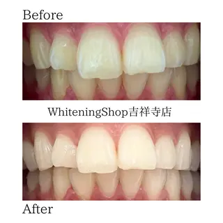 ホワイトニング ショップ吉祥寺店のエステ・リラクイメージ