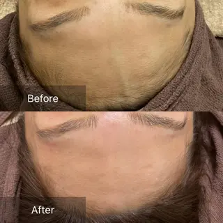 産毛専門店 Bittoのエステ・リラクイメージ