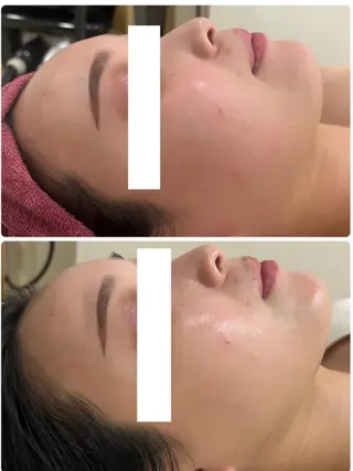 美乳バストサロン RAYVIS💍のエステ・リラクイメージ