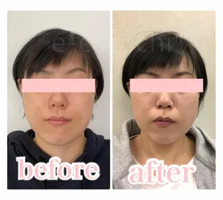 小顔と ヘッドスパのお店のエステ・リラクイメージ