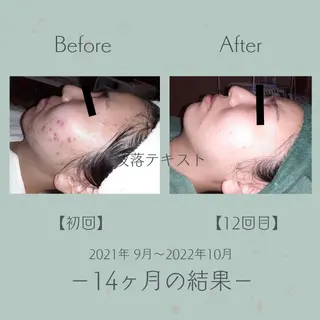 エステ＆美肌脱毛 ココサロ倉敷店のエステ・リラクイメージ