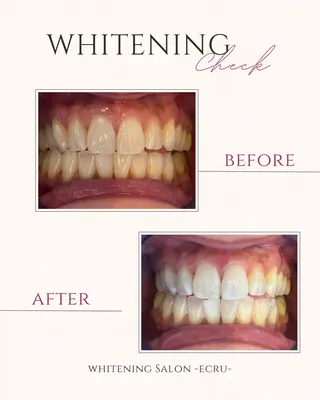 ホワイトニングサロン Ecru所属・オーナー Moeriのその他イメージ