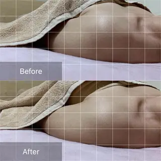 【頭痛、睡眠改善】 salon RUUのエステ・リラクイメージ