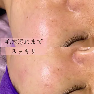 noheanc所属・次世代まつげパーマ フェイシャルワックスのマツエク・マツパデザイン