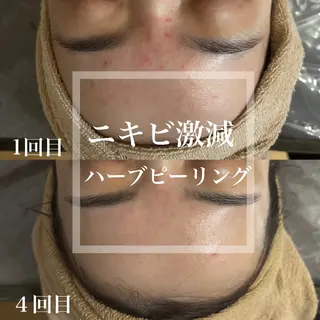 WHITE AQUA 北千住店のエステ・リラクイメージ