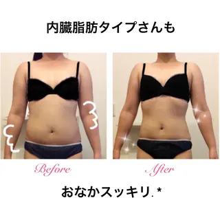 ダイエット・美肌ケア fleurのエステ・リラクイメージ