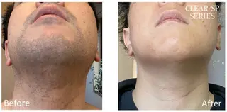 脱毛サロンat ikaw下北沢所属・at ikawのエステ・リラクイメージ