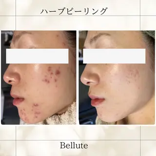 ピーリング専門店 Belluteのエステ・リラクイメージ