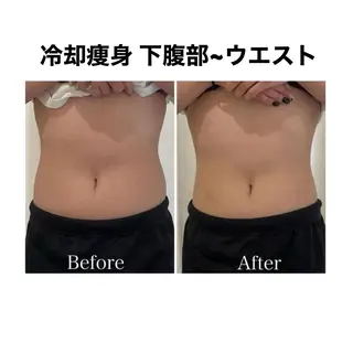 秒速小顔 東銀座店所属・秒速小顔 店長 yuiのエステ・リラクイメージ