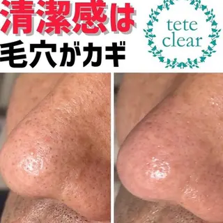 毛穴ケア専門サロン Yourmeユアミーのエステ・リラクイメージ