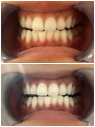 ホワイトニングジム 池袋のその他イメージ