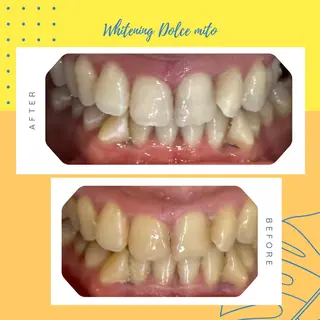 セルフホワイトニング Dolce水戸店のその他イメージ