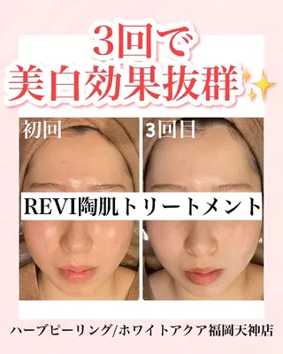 メンズ キッズ WHITEAQUA 福岡天神店のエステ・リラクイメージ