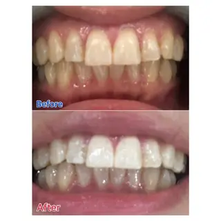 MBEAUTYSALON 千葉店・京成大久保所属・Melty 輝のその他イメージ