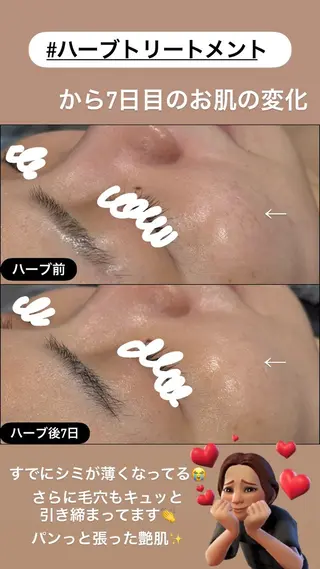 LiZA エステティックサロンのエステ・リラクイメージ