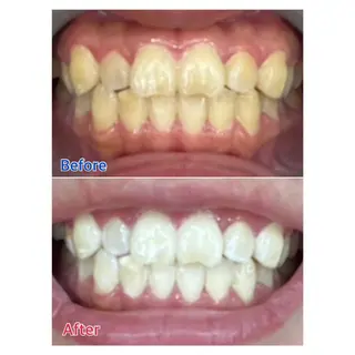 MBEAUTYSALON 千葉店・京成大久保所属・Melty 輝のその他イメージ