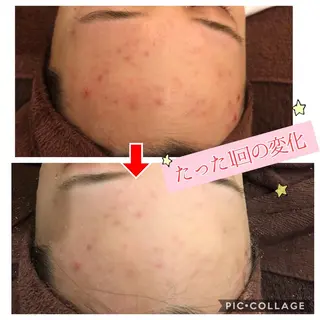 セミロング カラー パーマ ヘアアレンジ メンズ キッズ ネイル マツエク・マツパ 四つ星サロン🎖 腸＆ニキビケアに特化のエステ・リラクイメージ