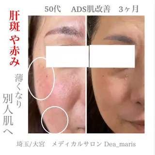 private salon Dea_maris シュガーリング&パーソナルボディケア所属・シミ改善・韓国肌管理 ボディメイク痩身のその他イメージ