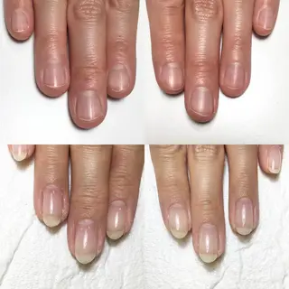 ネイル 自爪育成・巻き爪 補正講師　津蔵のネイルデザイン