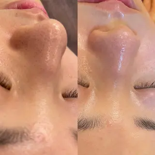 西区九条エステ MITUREIサロンのエステ・リラクイメージ