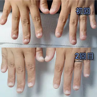 ネイル 島屋 千奈美のネイルデザイン