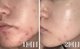 EYE LASH LAPISのエステ・リラクイメージ