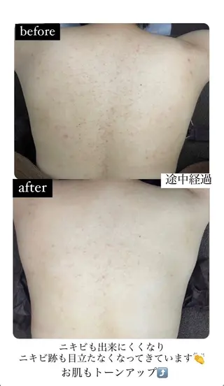 ベラージュ【美背中・ 美尻・フェイシャル】のエステ・リラクイメージ