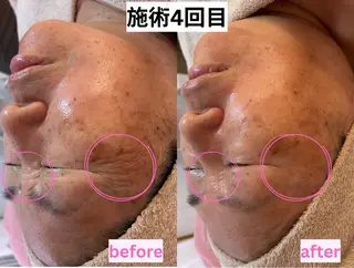 アドミーロ 💎CHIKA💎のエステ・リラクイメージ