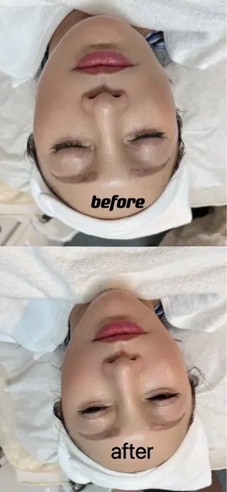 U・mi ユキのマツエク・マツパデザイン