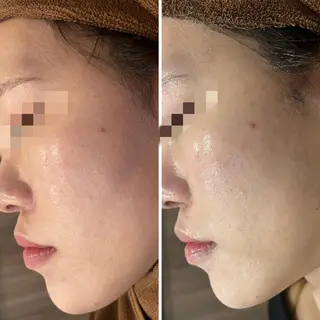 セミロング カラー パーマ ヘアアレンジ メンズ キッズ ネイル マツエク・マツパ アイブロウ Amaryllis 🌹松本のエステ・リラクイメージ